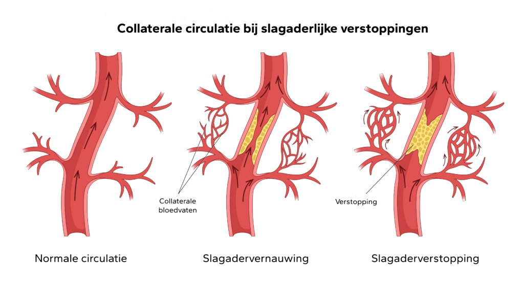 Collaterale circulatie